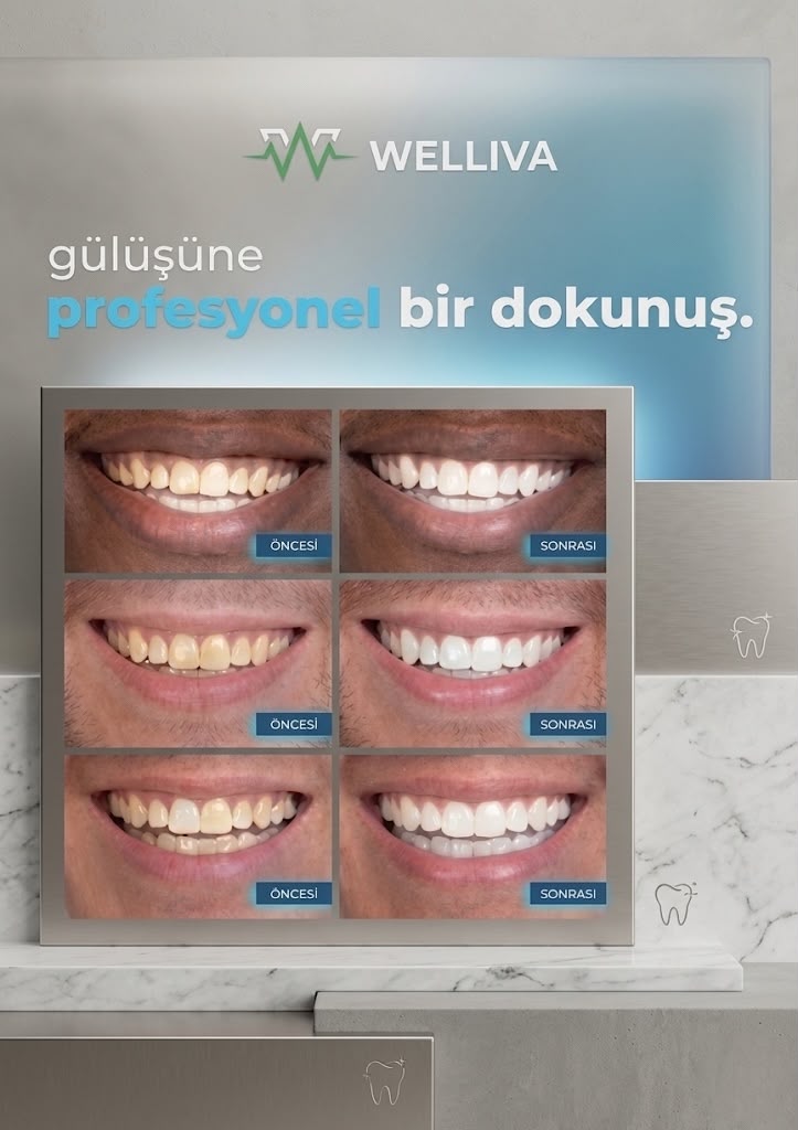 Diş Beyazlatma Bandı, Profesyonel Beyazlık, 14
Paket-28 Bant