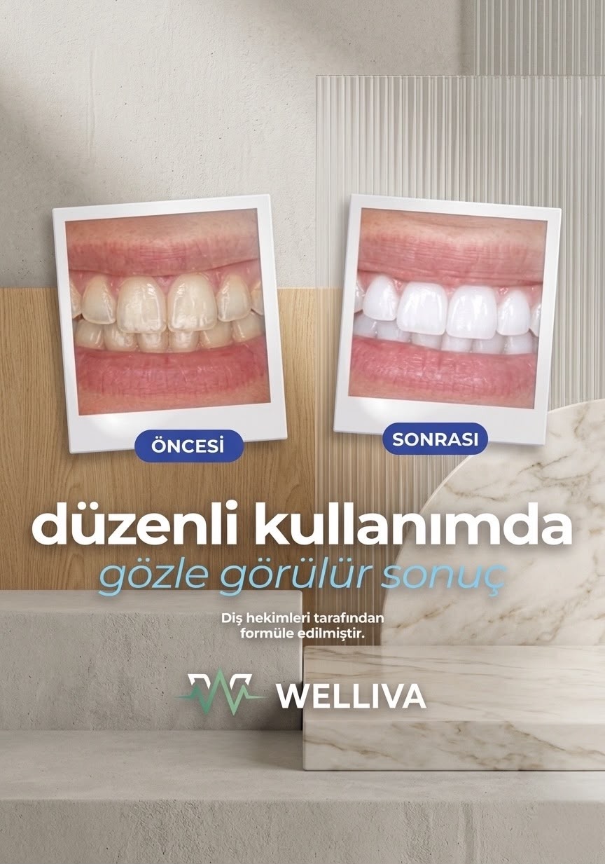 Diş Beyazlatma Bandı, Profesyonel Beyazlık, 14
Paket-28 Bant